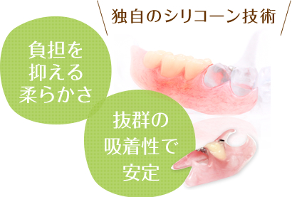 コンフォートデンチャー